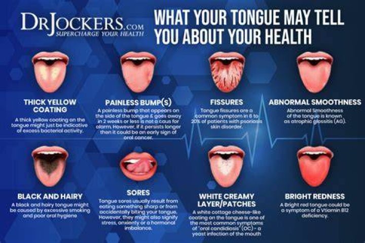 What causes your tongue to stop working?